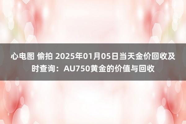 心电图 偷拍 2025年01月05日当天金价回收及时查询：AU750黄金的价值与回收